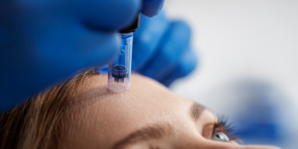 Skinpen Microneedling in Altrincham: Recovery Tips for Faster Healing