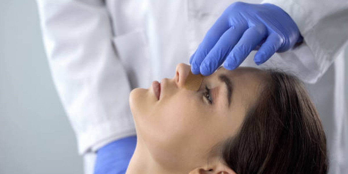 Rhinoplasty Healing: Surgery to Final Results